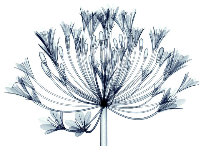 Xray A