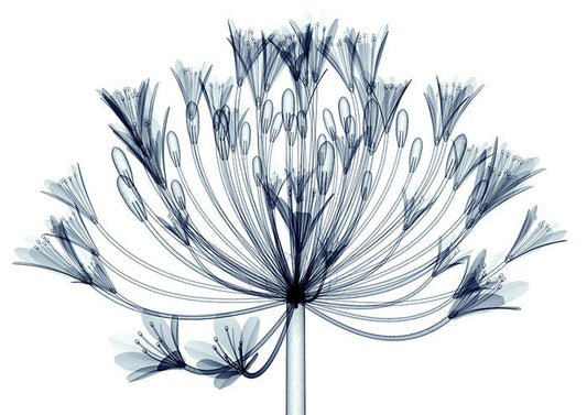 Xray A